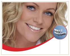 Slider image (7) Cheema Dental Implant Centre